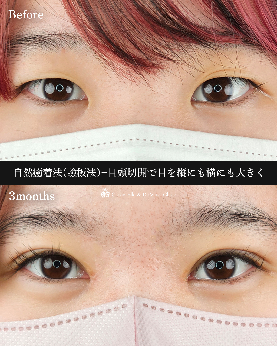 縦・横幅を大きくの画像