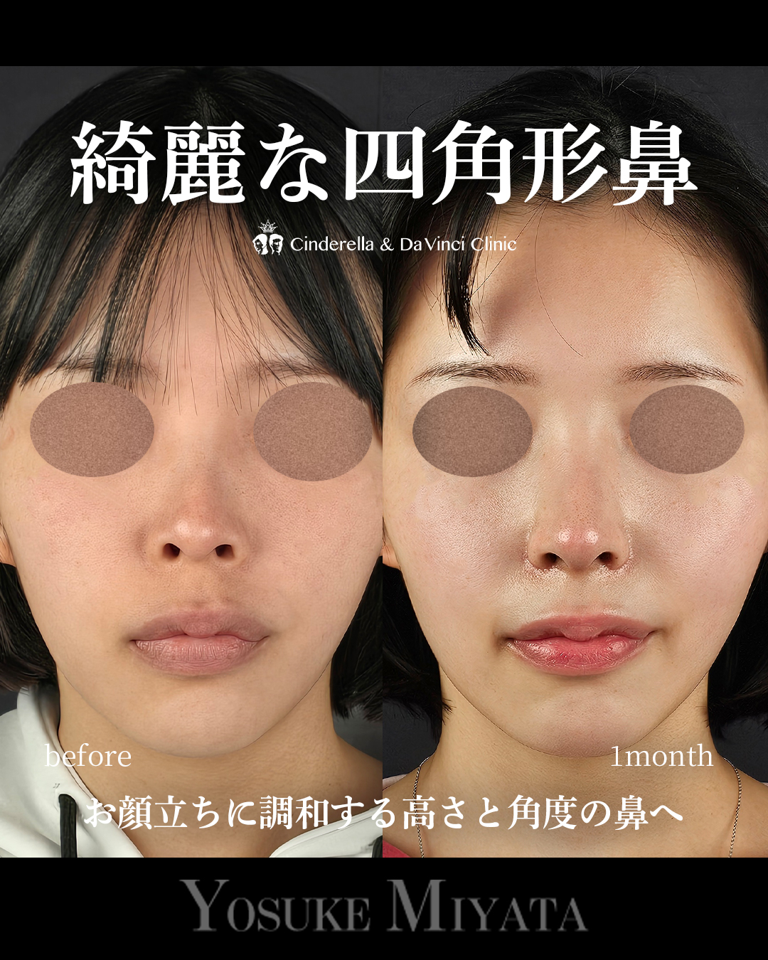 綺麗な四角形鼻の画像