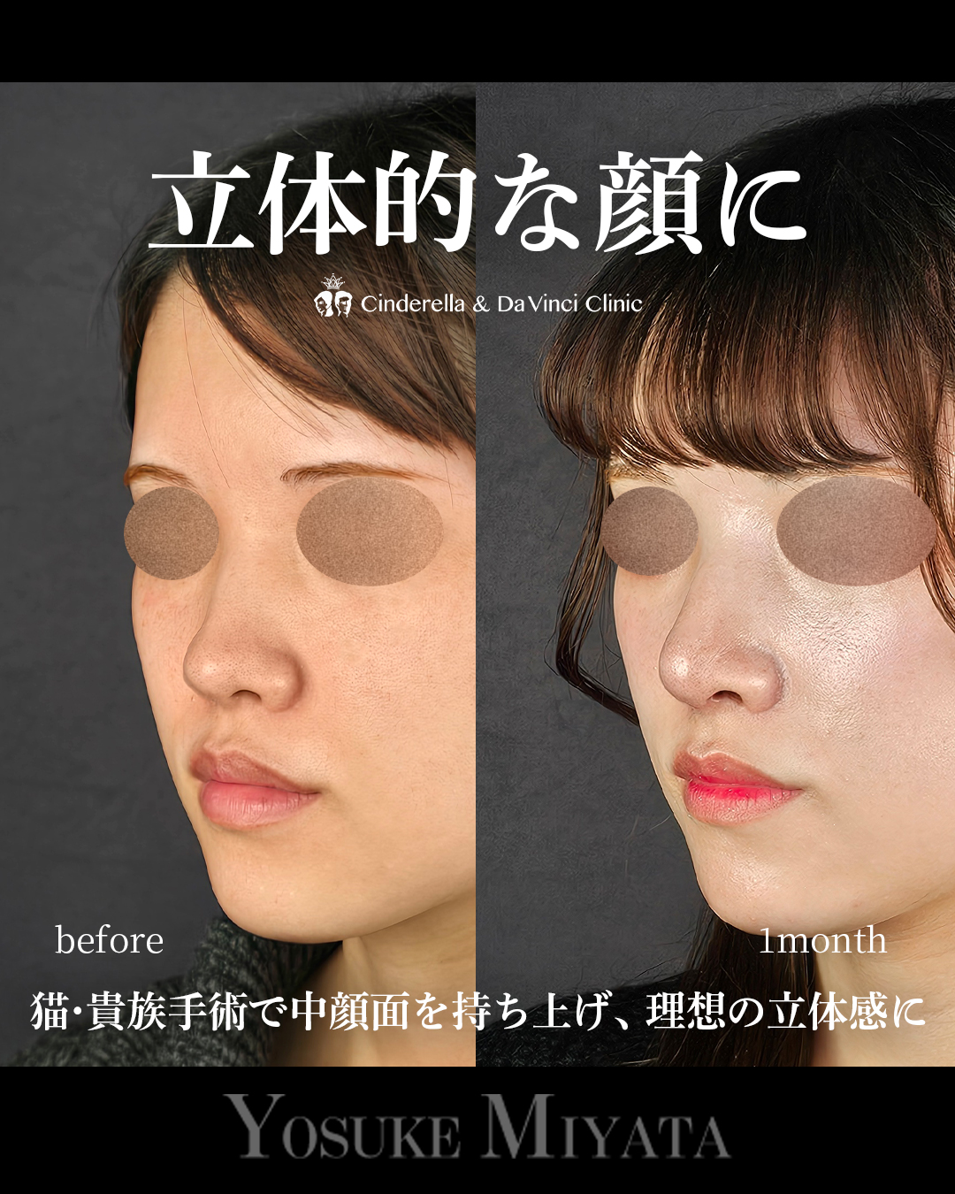 立体的な顔にの画像