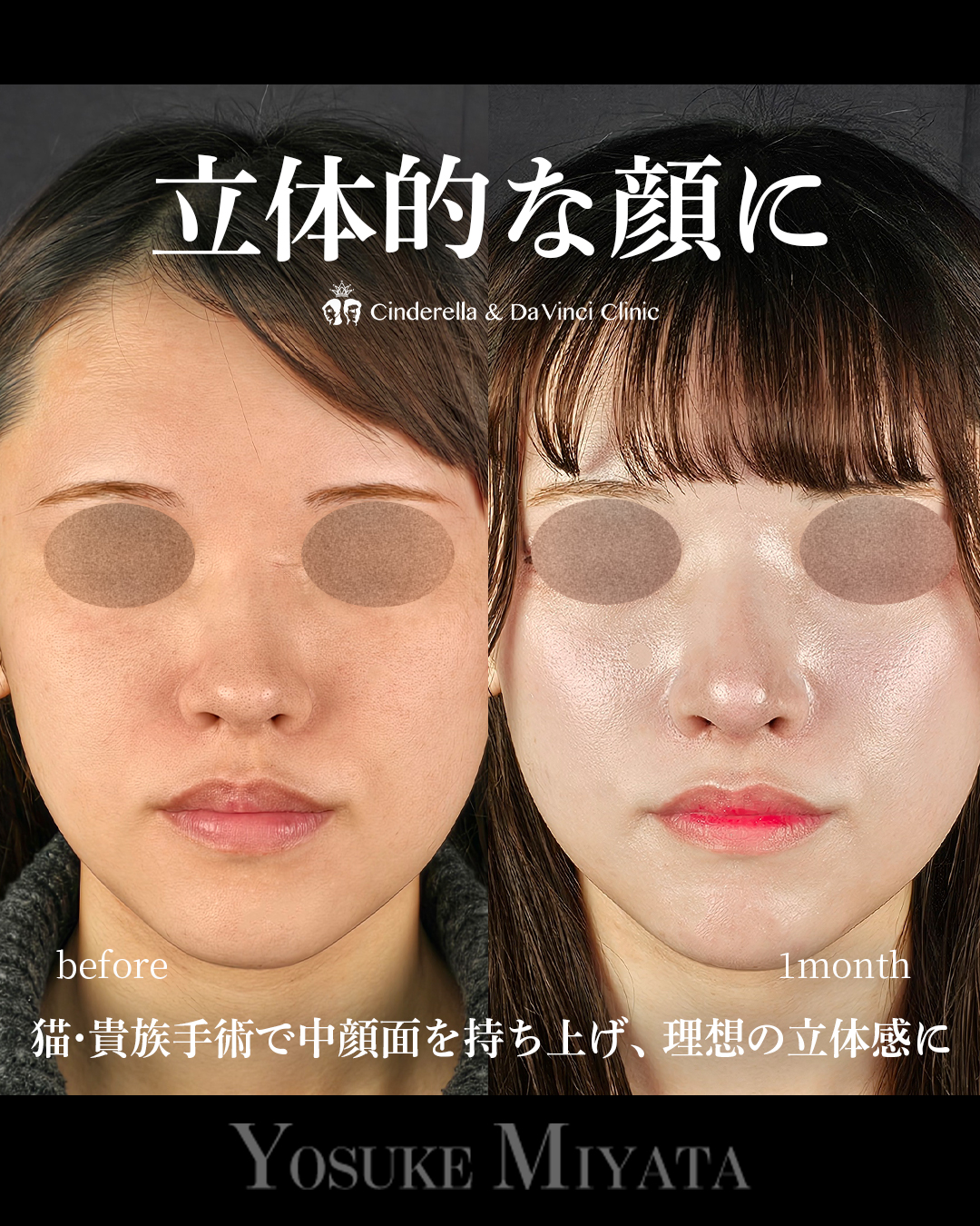 立体的な顔にの画像