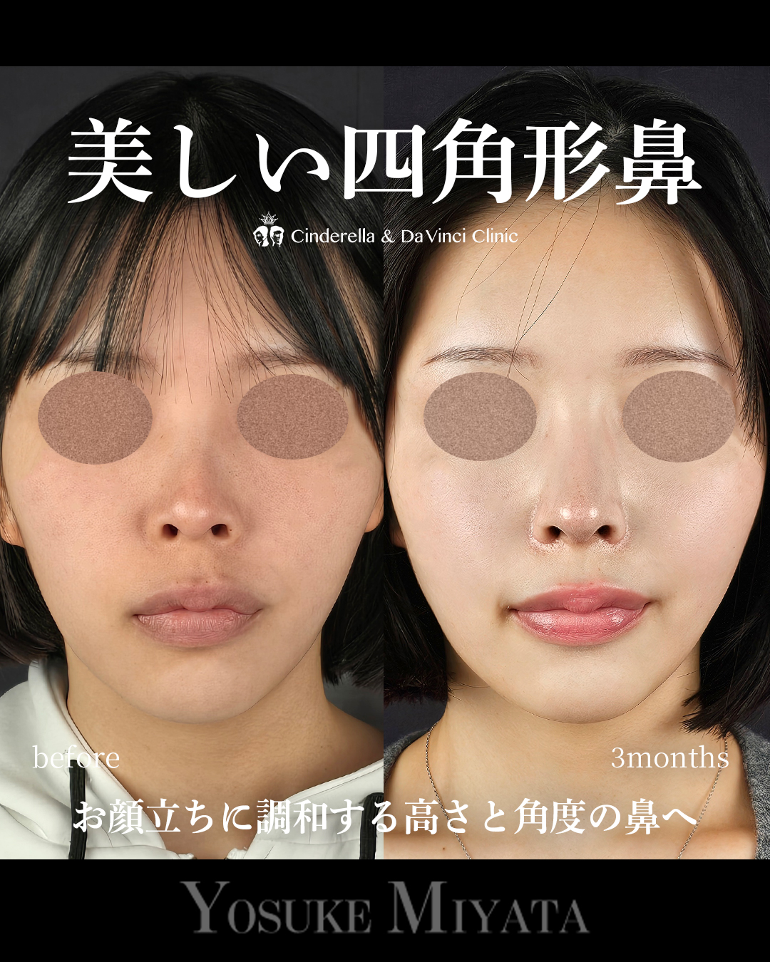 綺麗な四角形鼻の画像