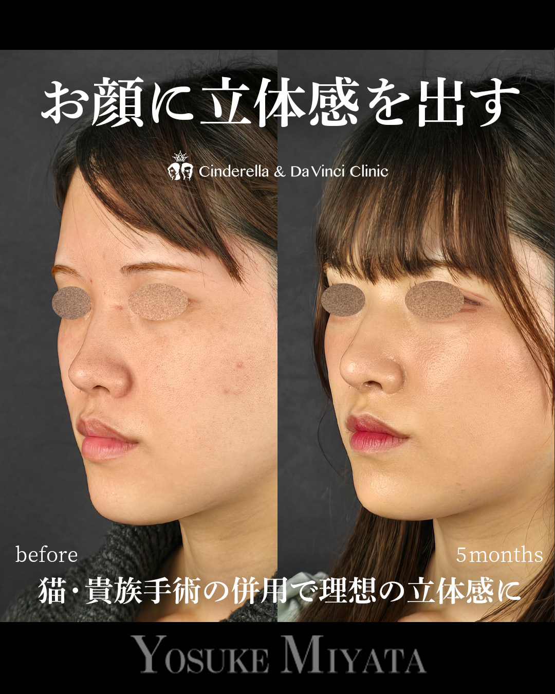 立体的な顔にの画像