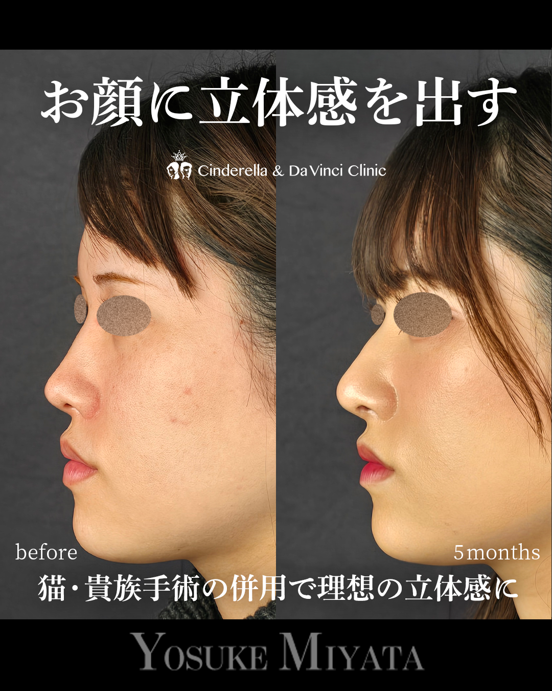 立体的な顔にの画像