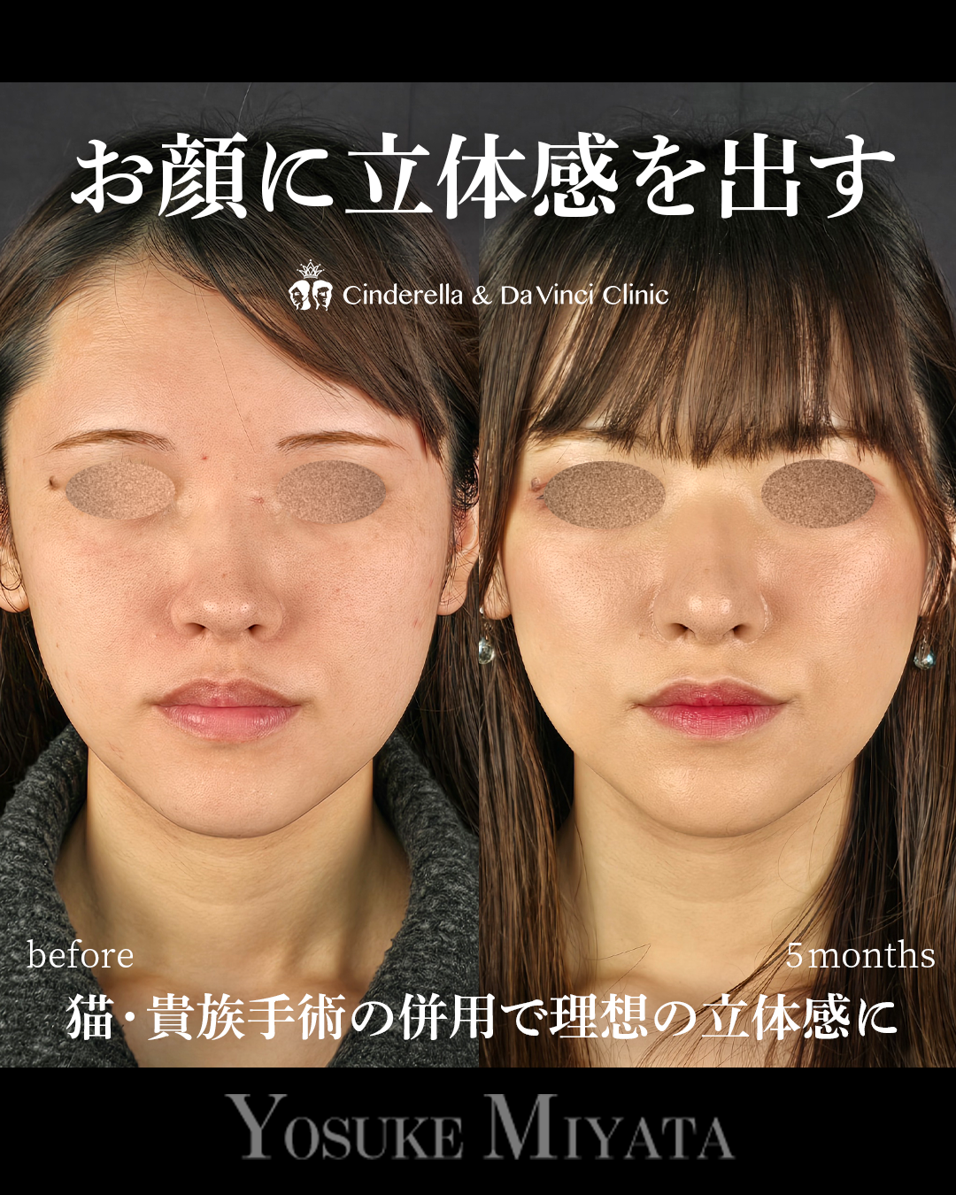 立体的な顔にの画像