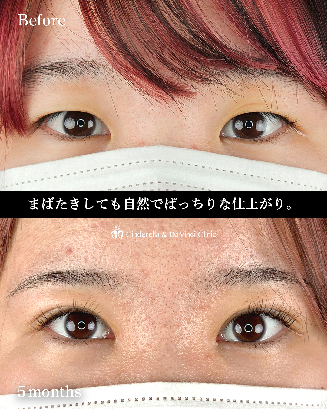 縦・横幅を大きくの画像