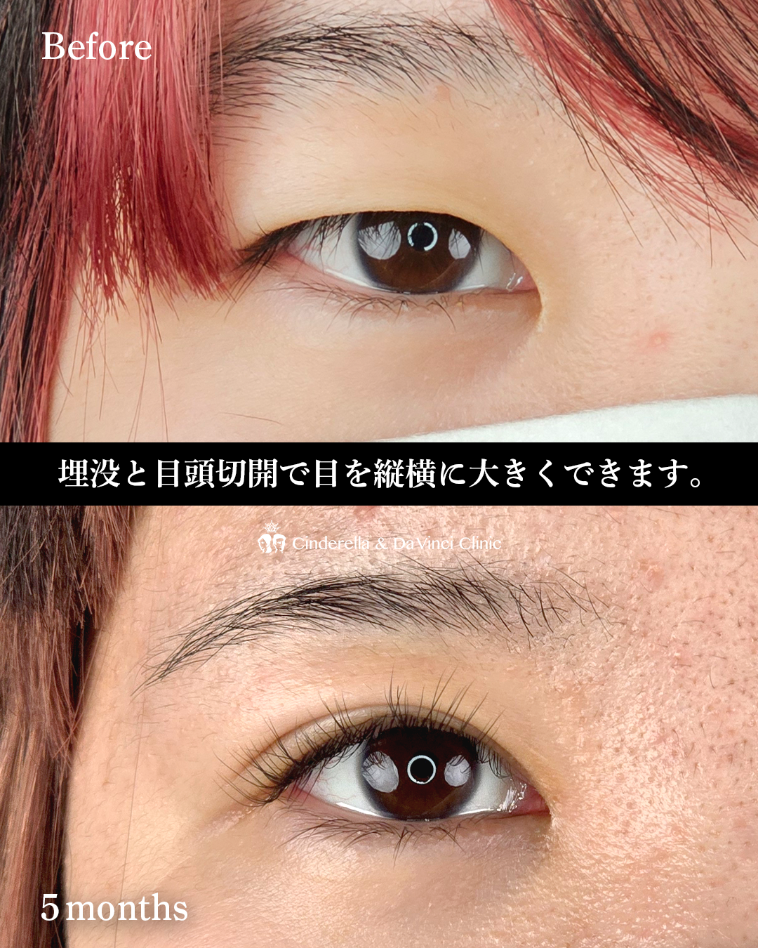 縦・横幅を大きくの画像