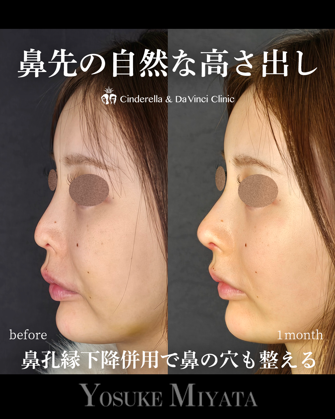 鼻先に自然な高さ