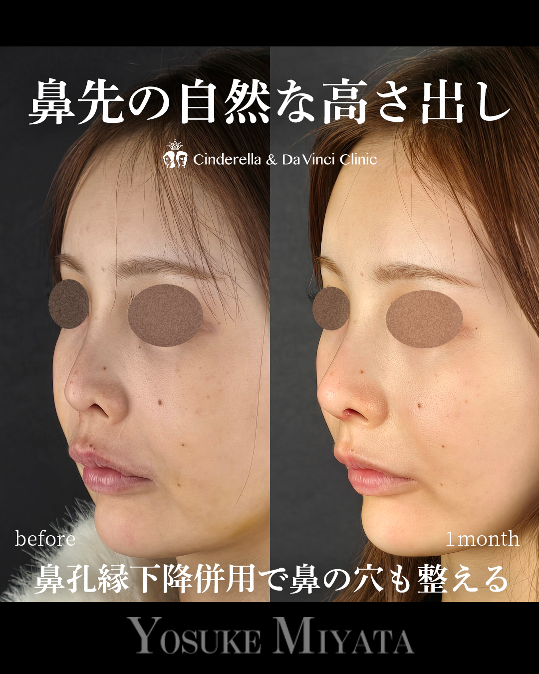 鼻先に自然な高さの画像