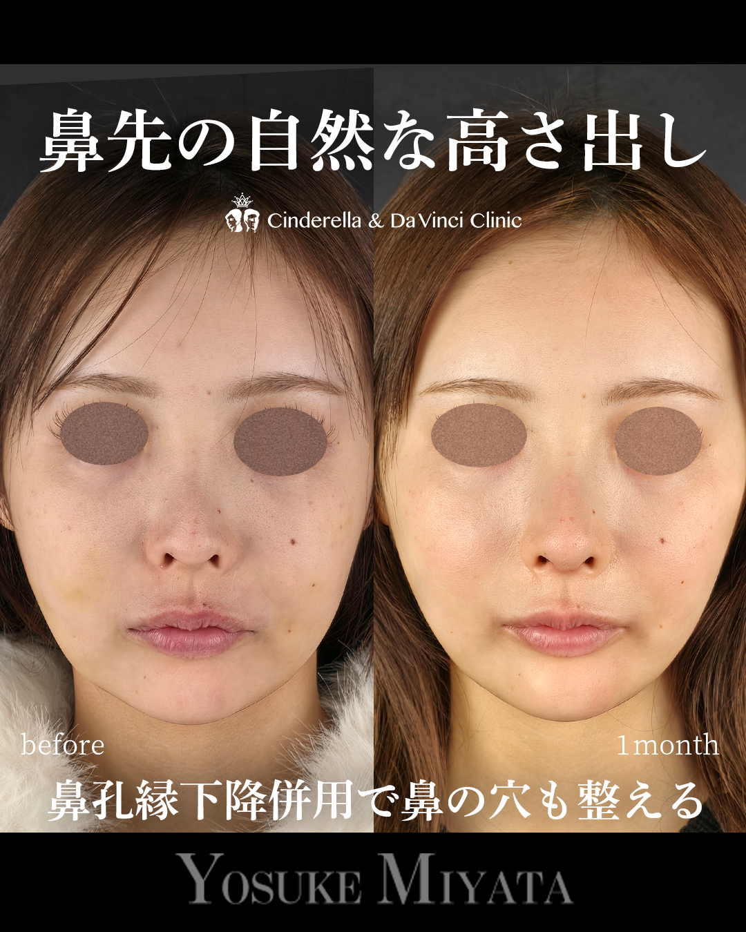 鼻先に自然な高さの画像