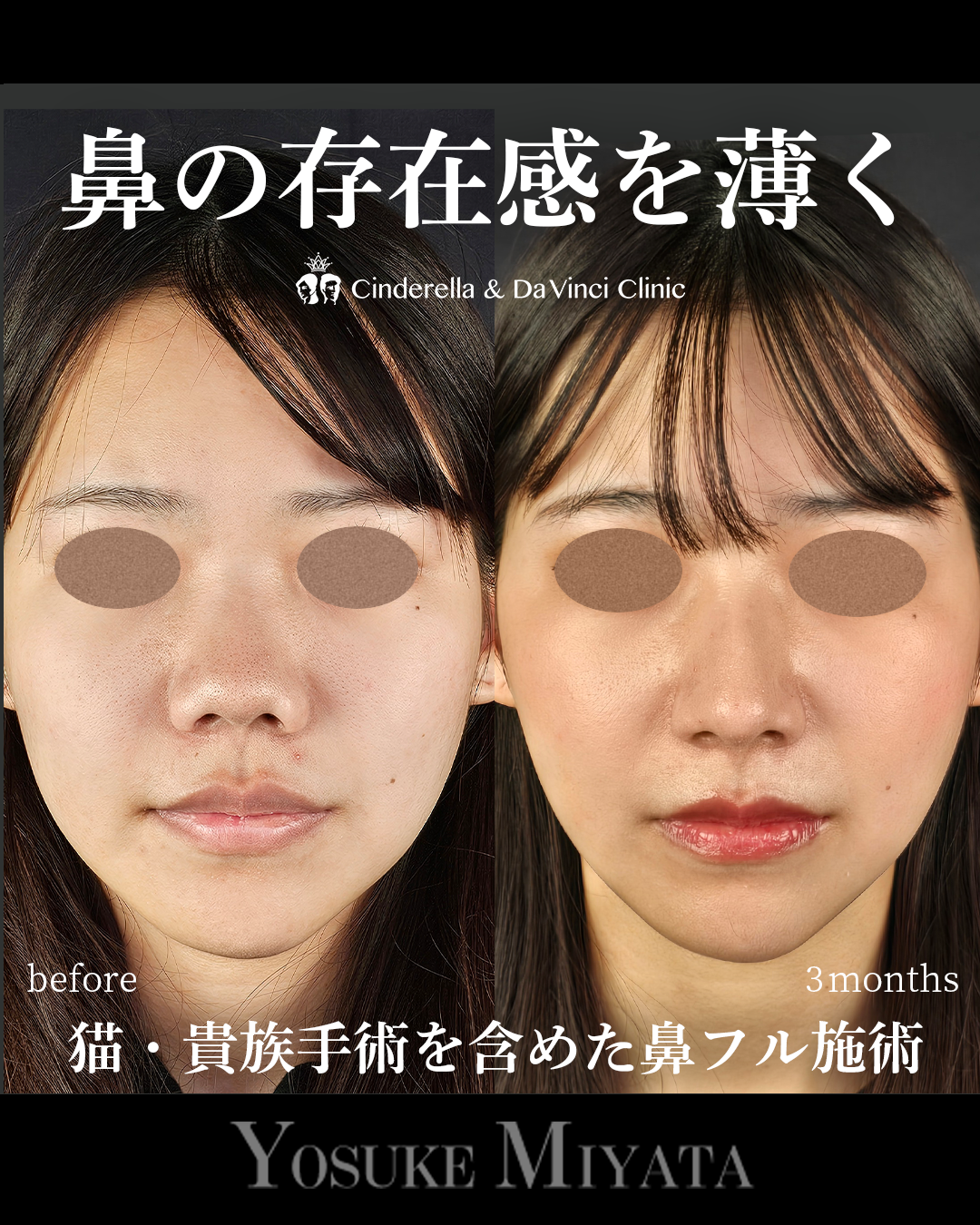 鼻の存在感を薄く