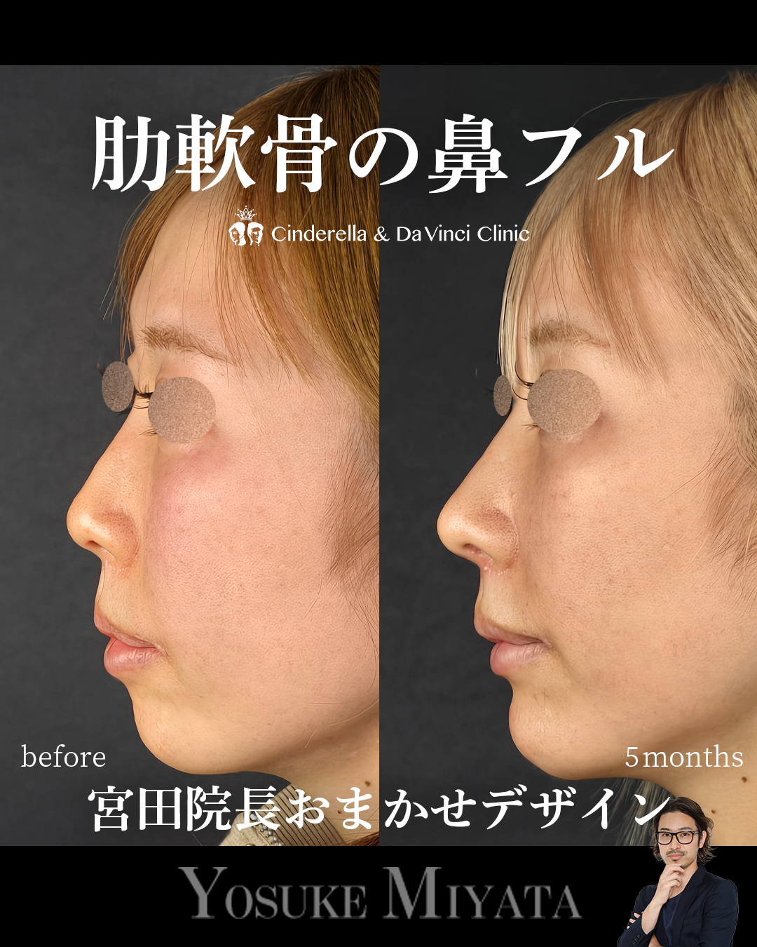 お任せデザインの画像