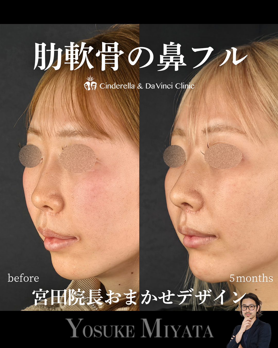 お任せデザインの画像