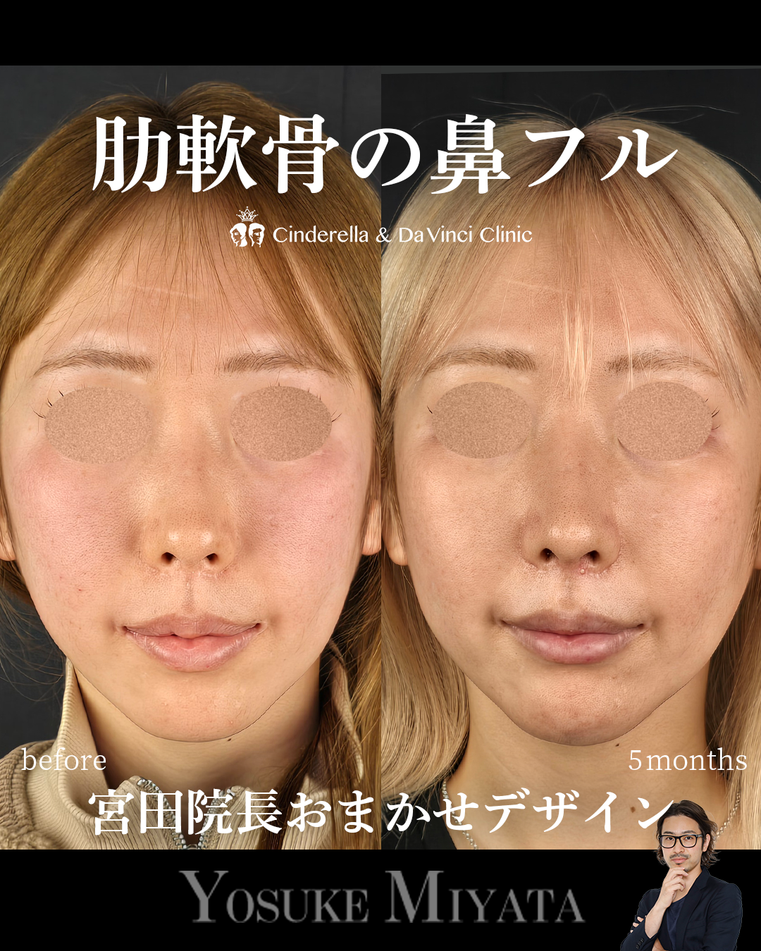 お任せデザインの画像