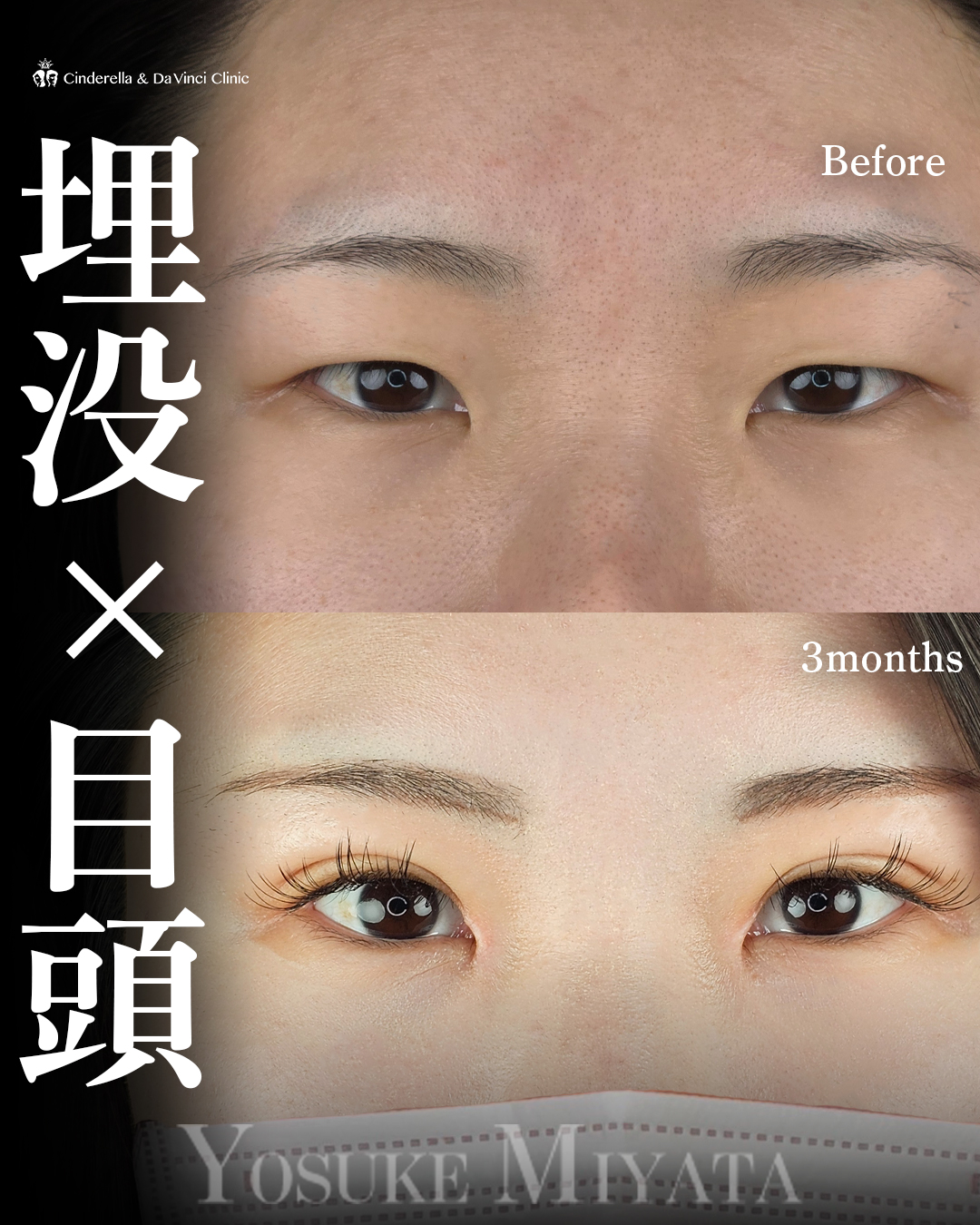 目頭併用で華やか目