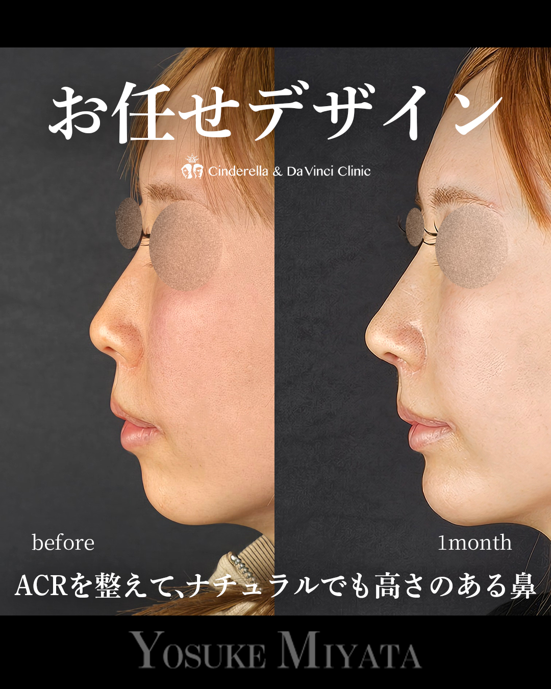 お任せデザイン