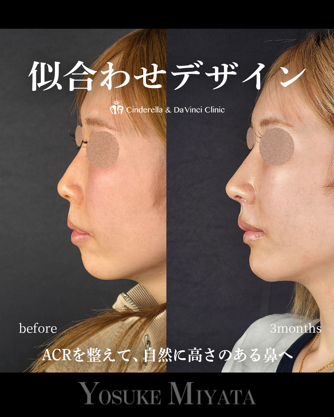 お任せデザインの画像