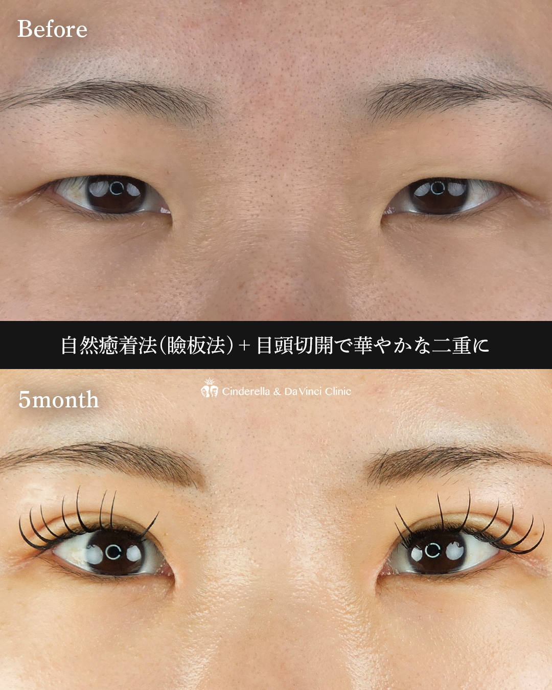 目頭併用で華やか目の画像