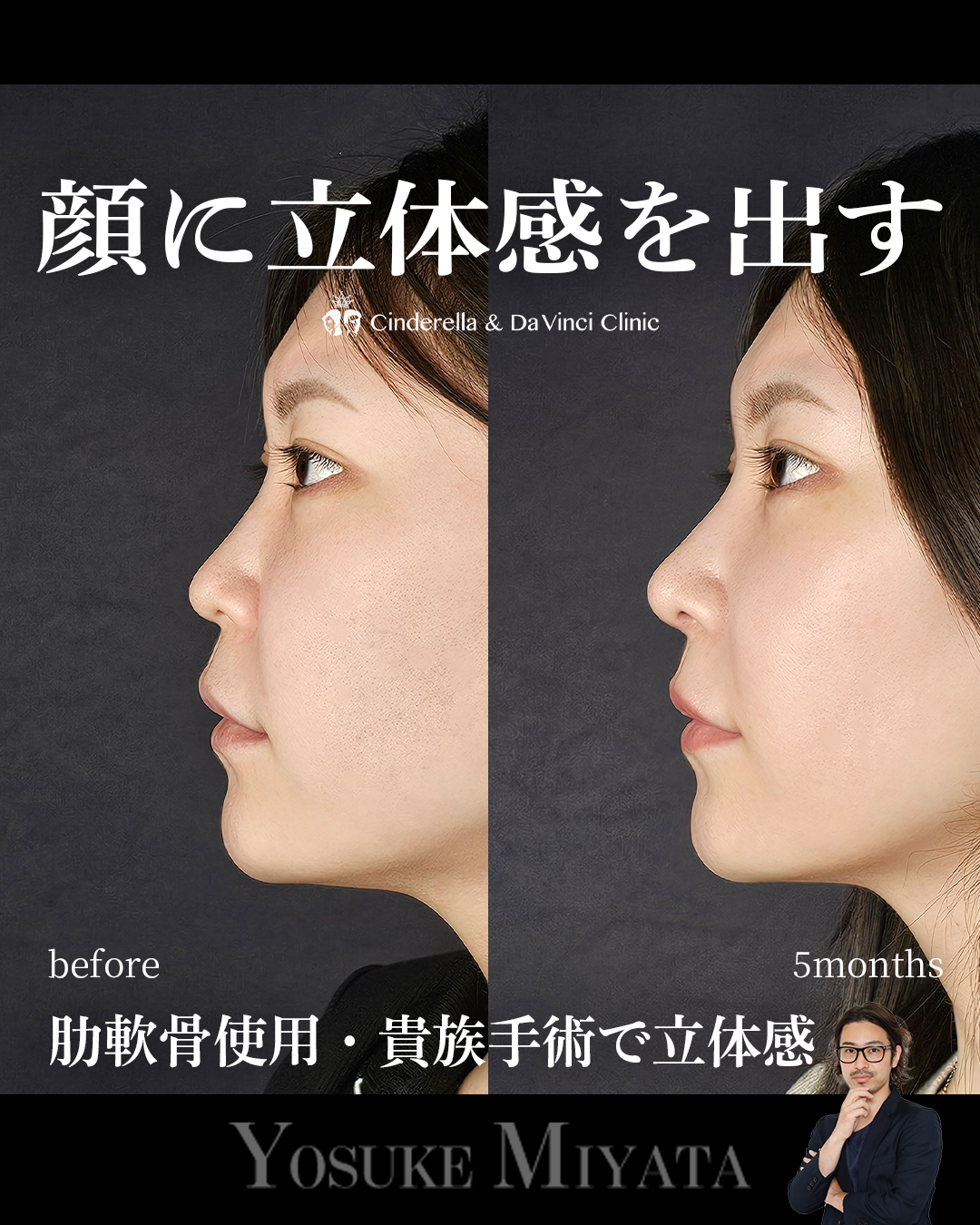 立体的な顔にの画像