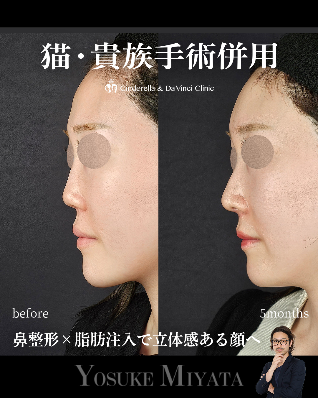 顔に立体感を出すの画像
