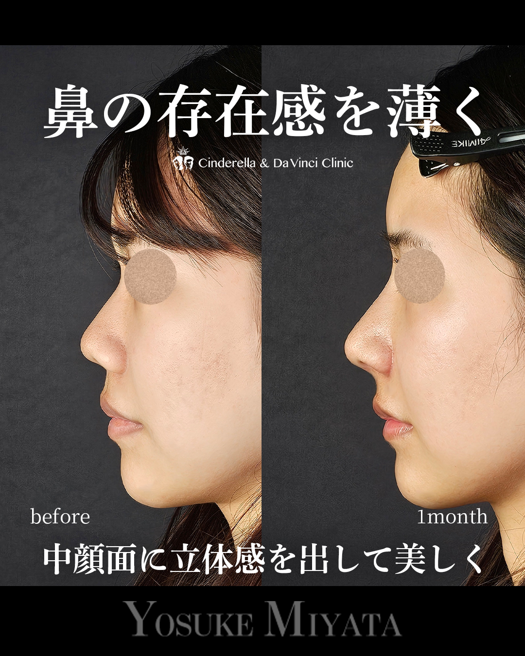 鼻の存在感を薄く