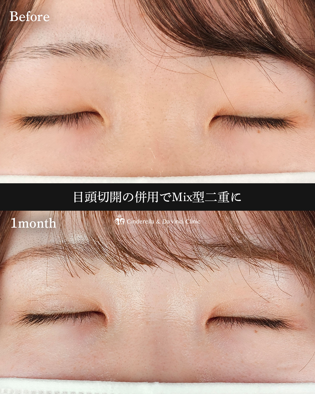 理想のMix型への画像