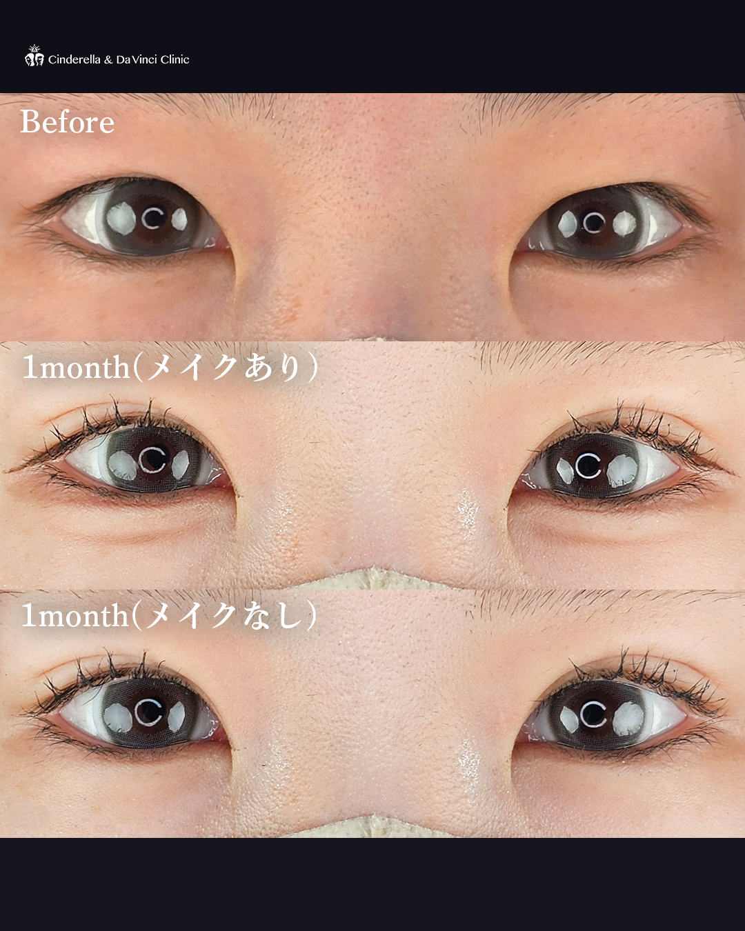 可愛らしい二重の画像