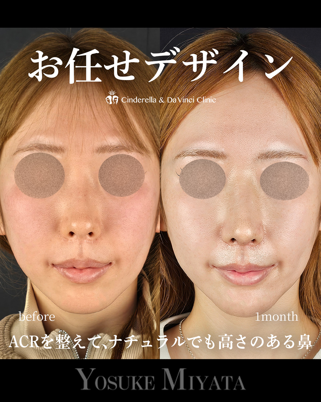 お任せデザインの画像