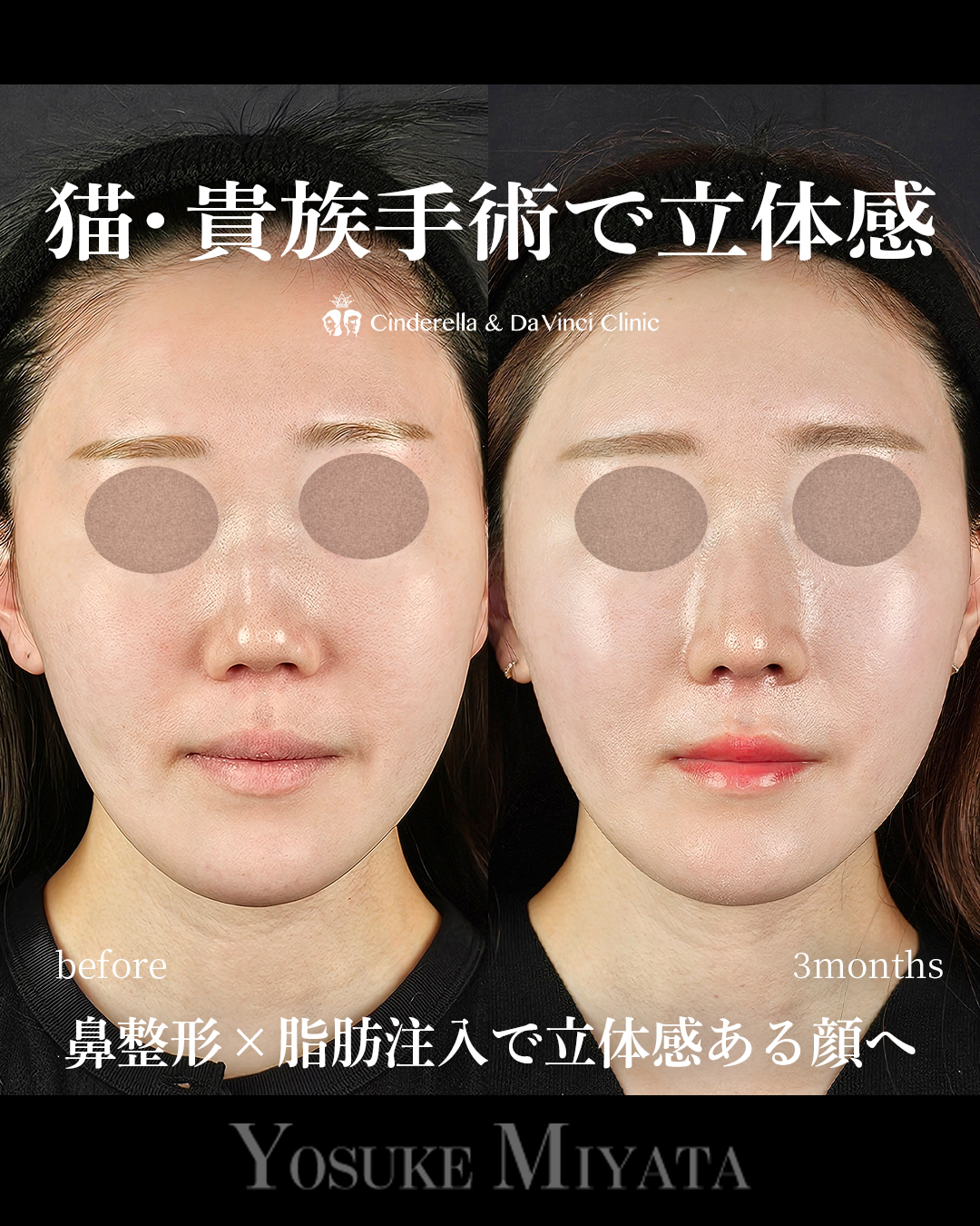 顔に立体感を出すの画像