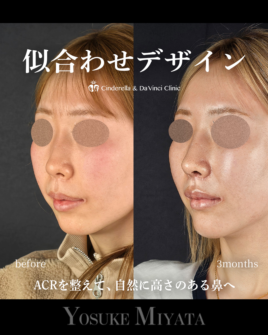 お任せデザインの画像