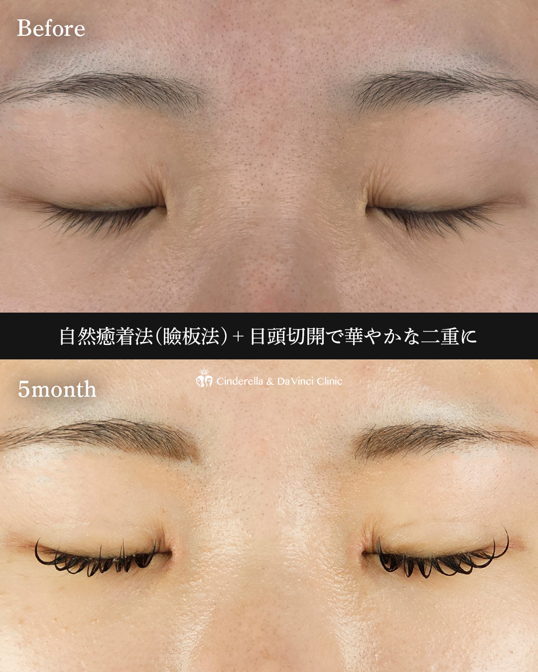 目頭併用で華やか目の画像