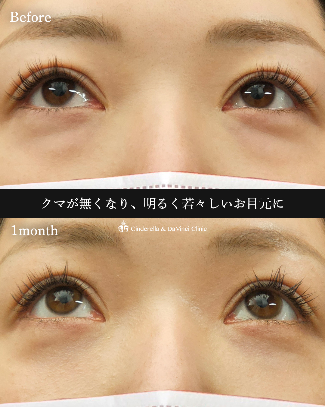 明るい目元への画像