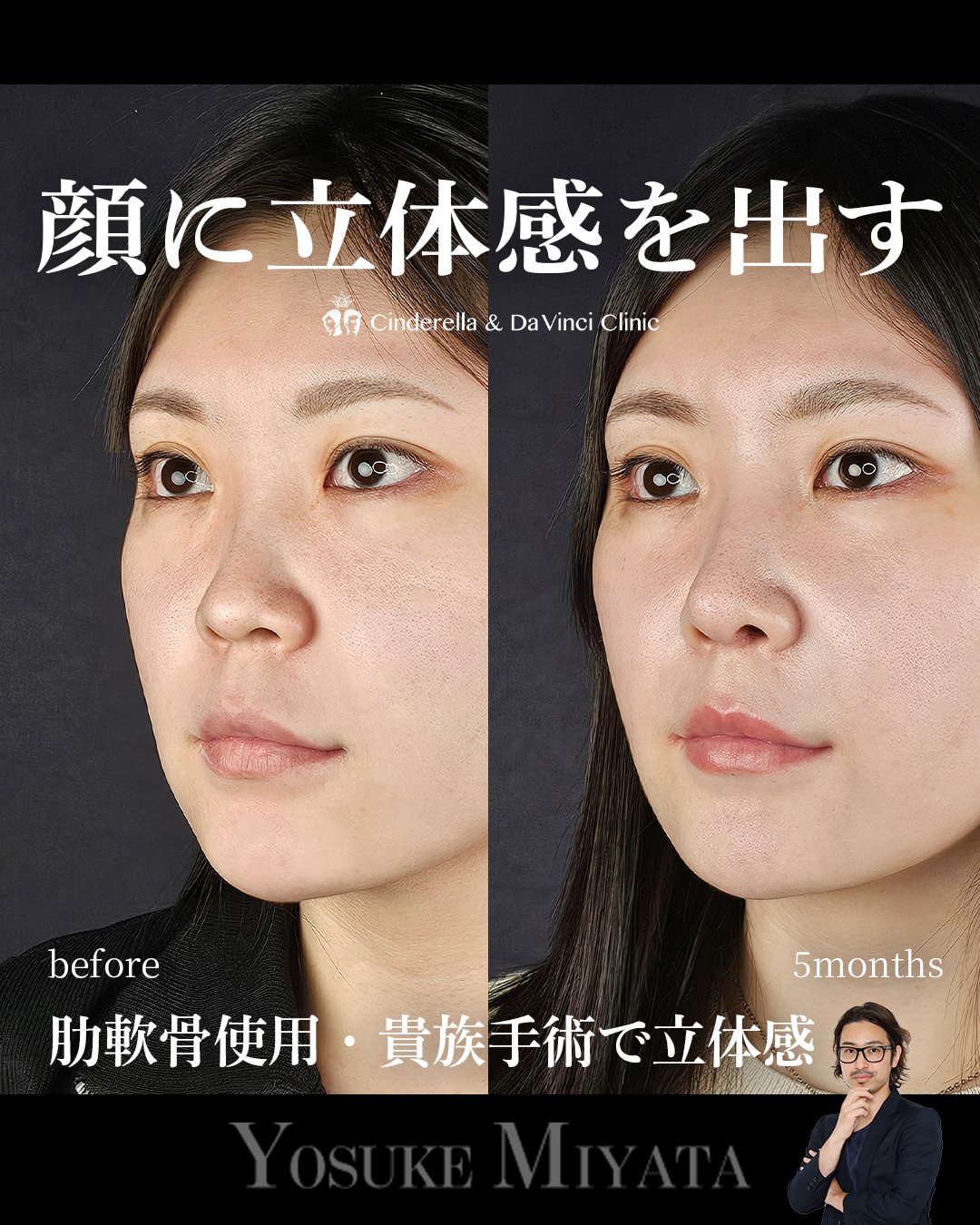 立体的な顔にの画像