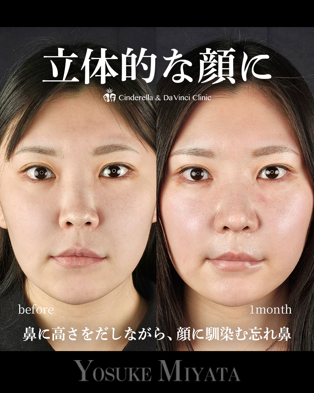 立体的な顔にの画像