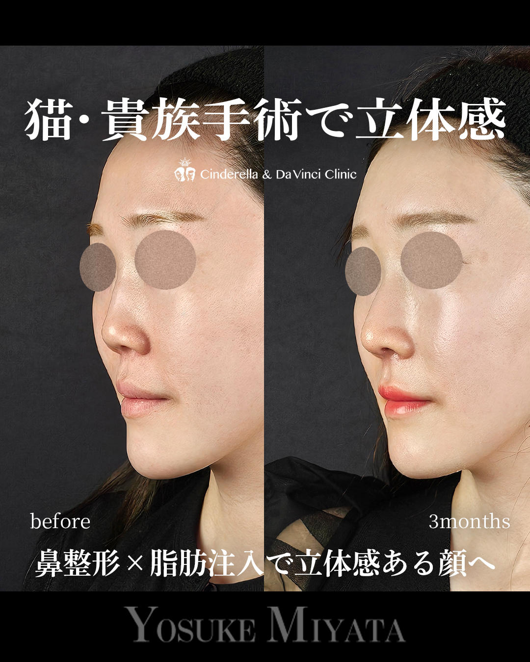 顔に立体感を出すの画像