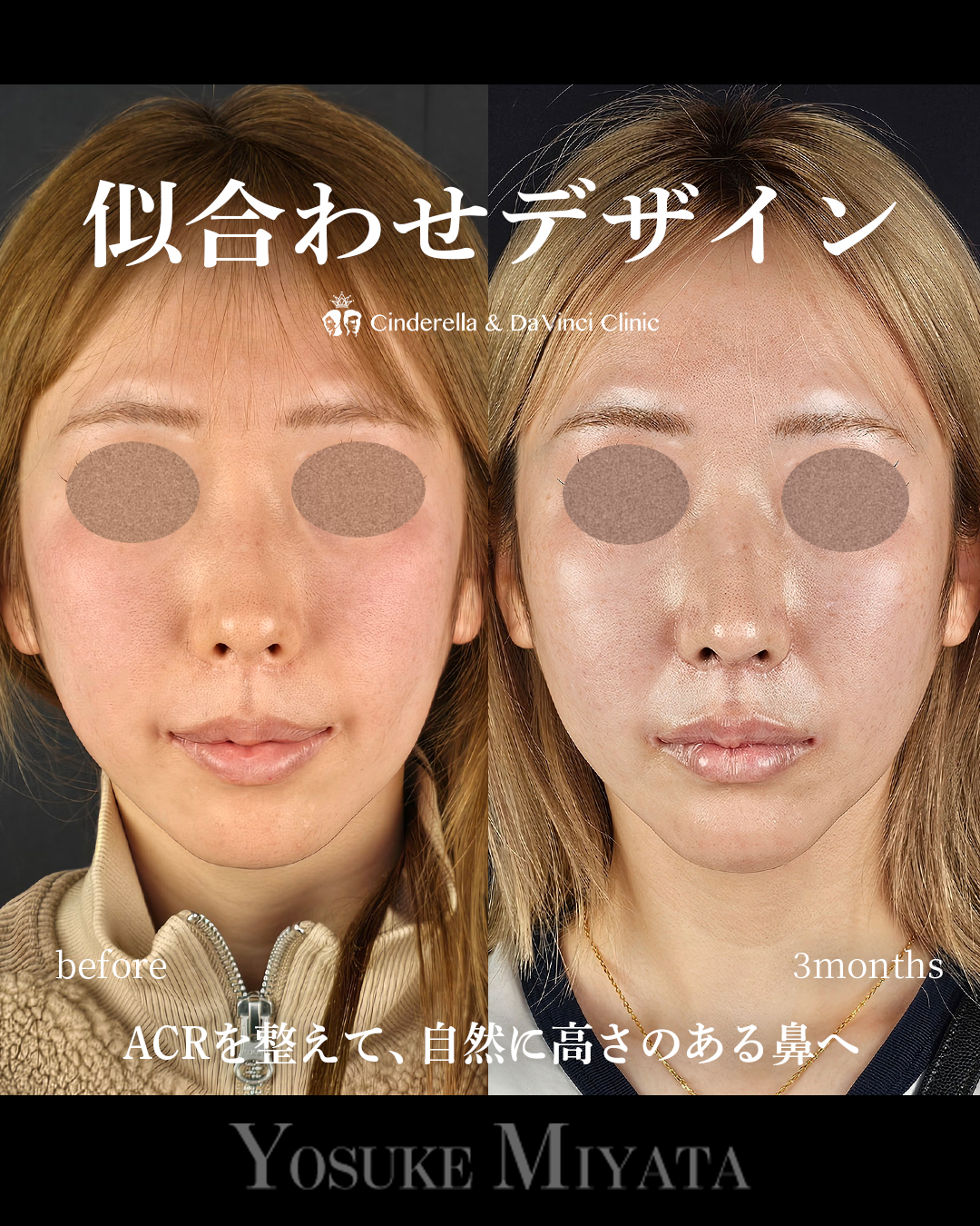 お任せデザインの画像