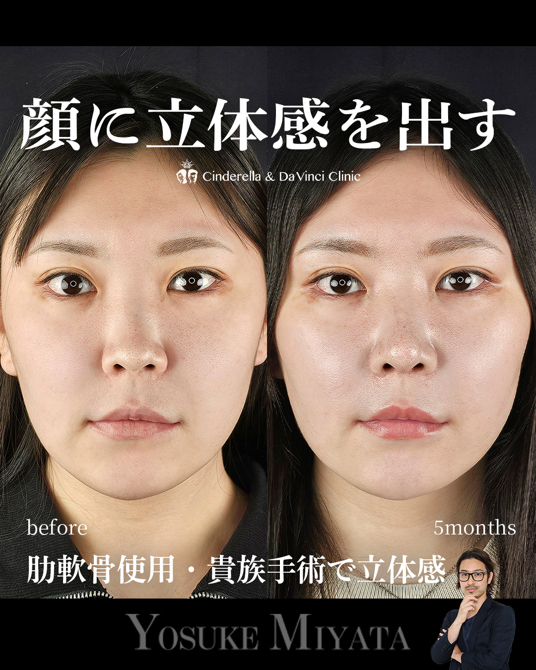 立体的な顔にの画像