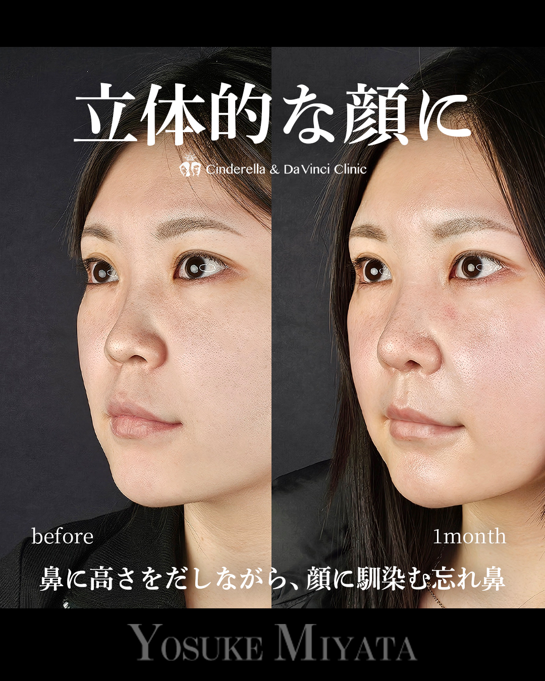 立体的な顔にの画像