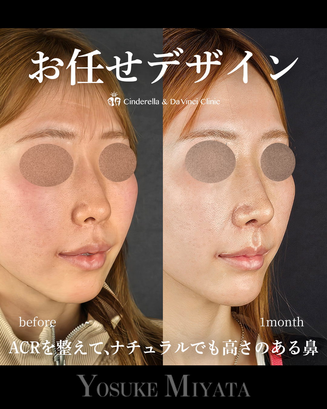 お任せデザインの画像