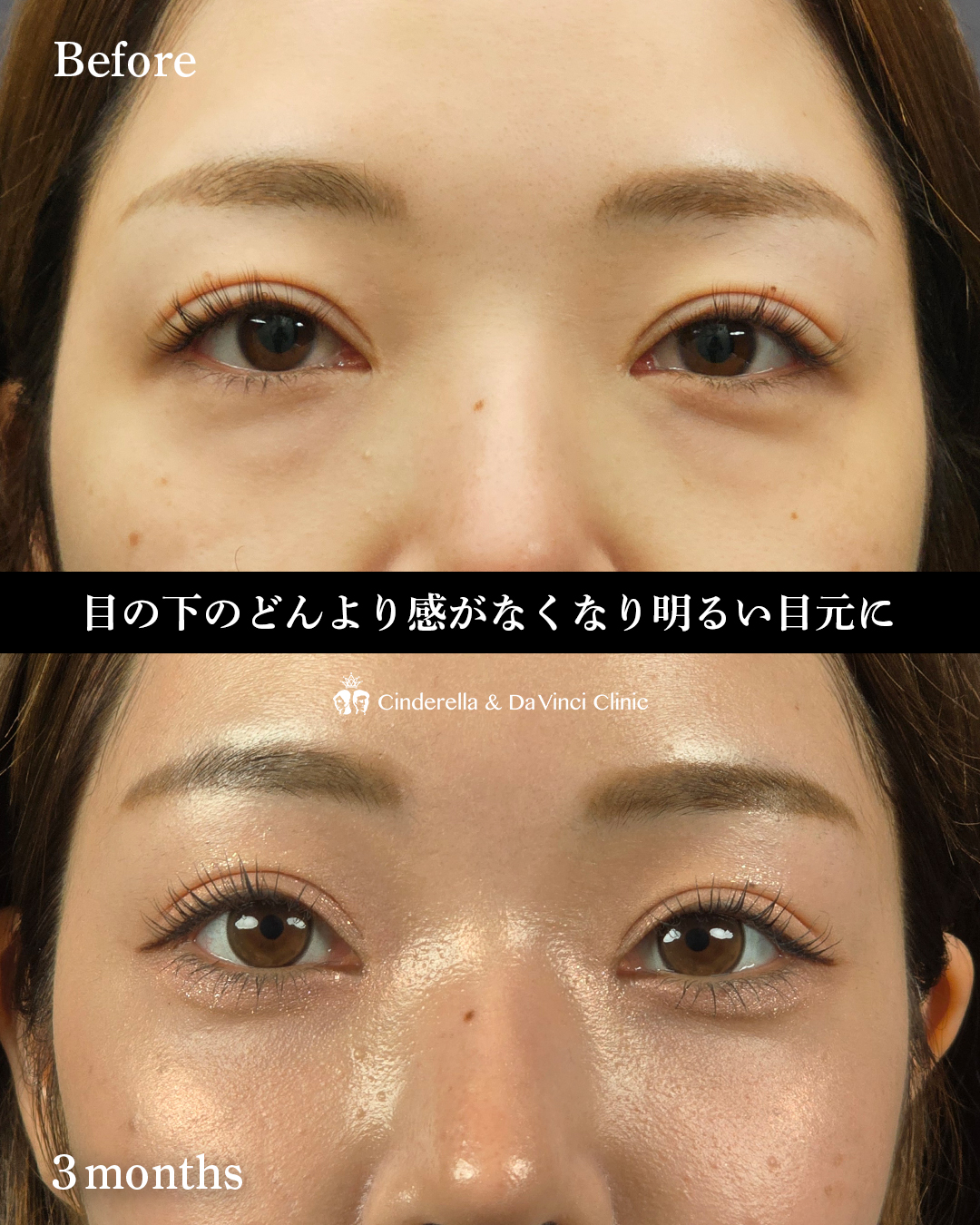 明るい目元への画像