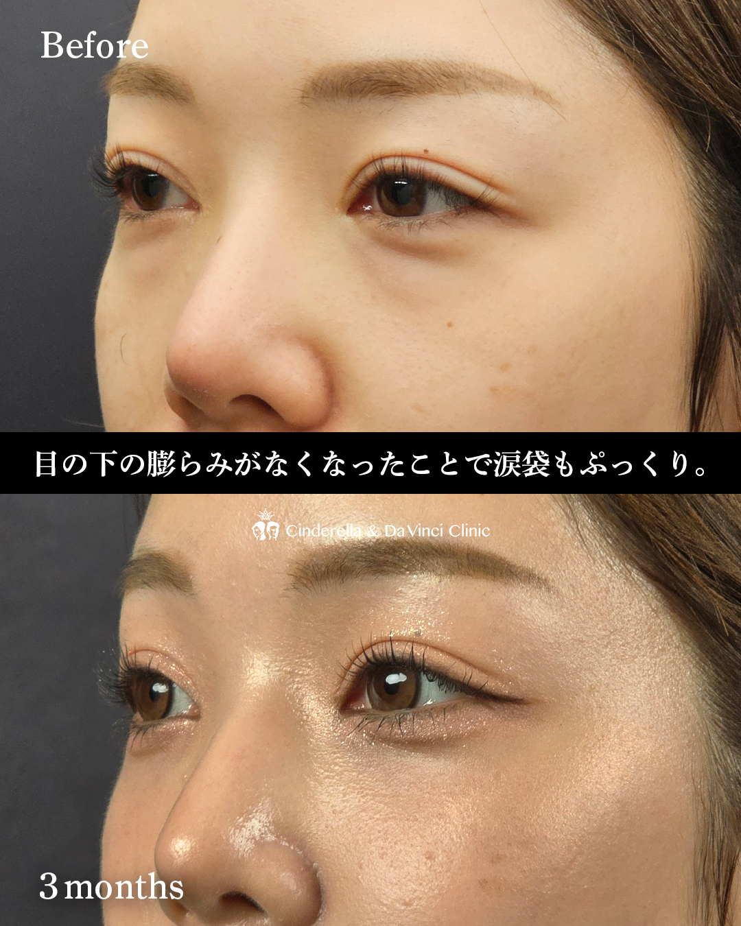 明るい目元への画像