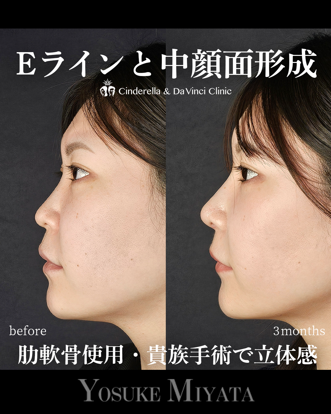 立体的な顔にの画像