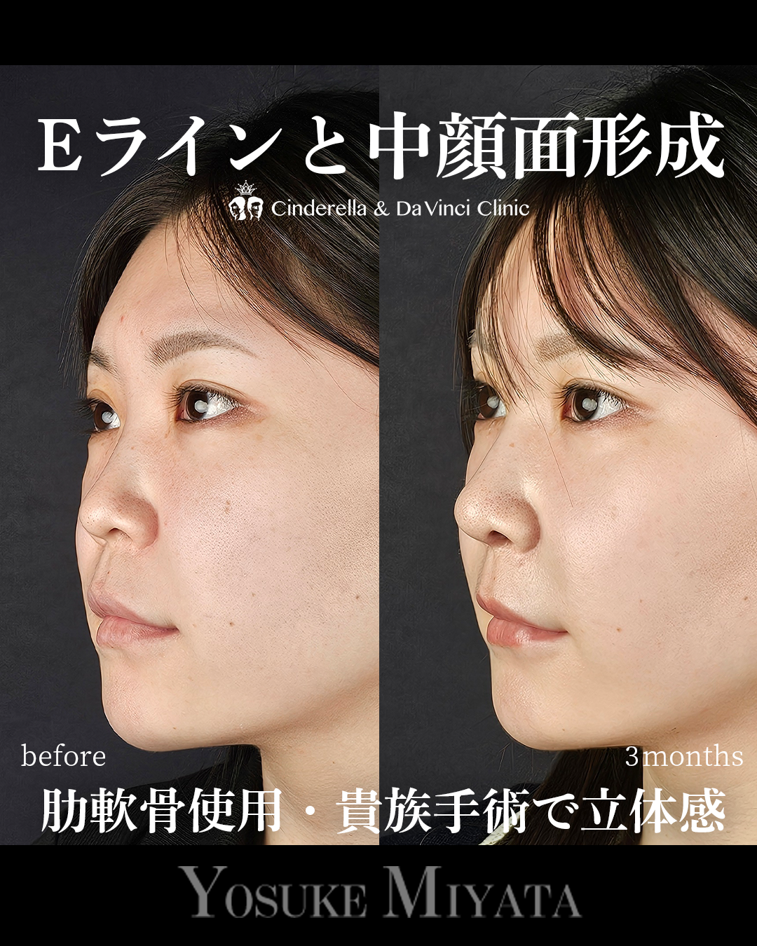 立体的な顔にの画像
