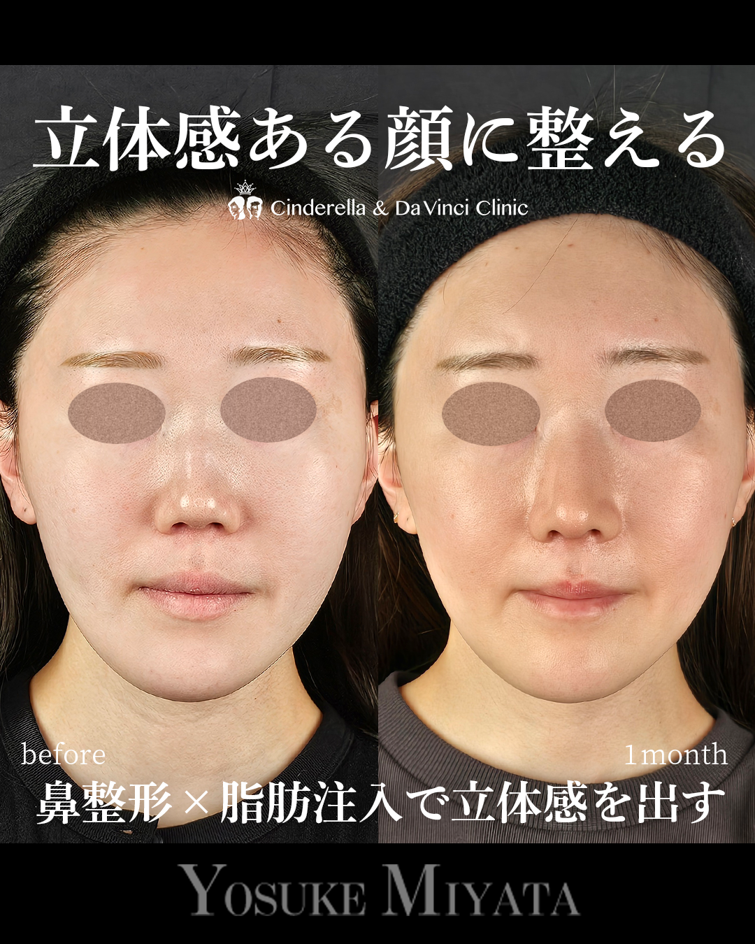 顔に立体感を出すの画像