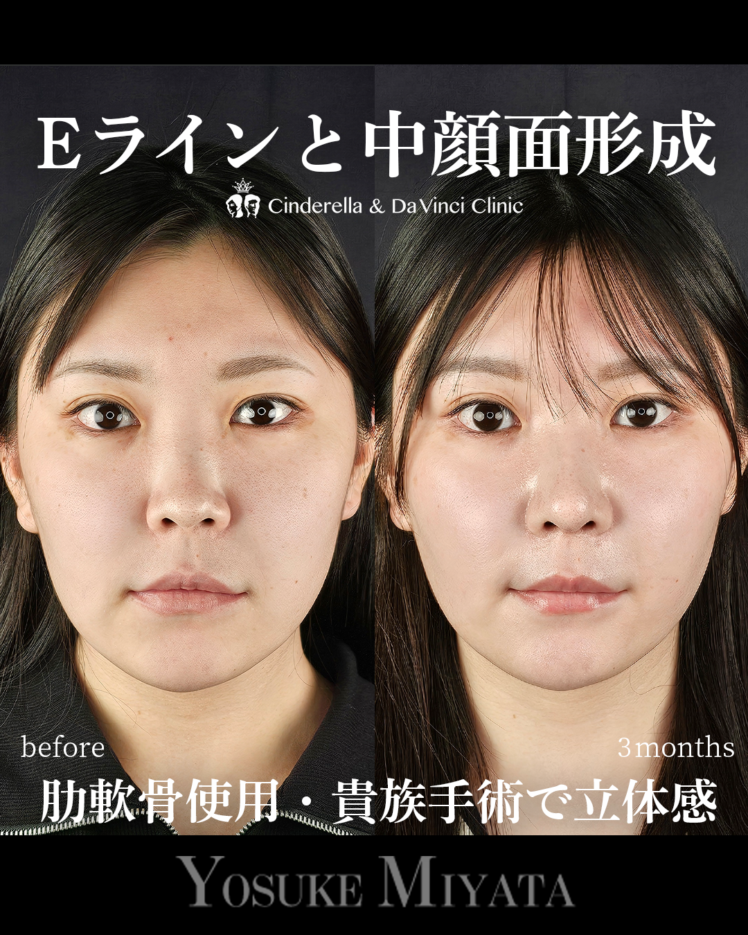 立体的な顔にの画像