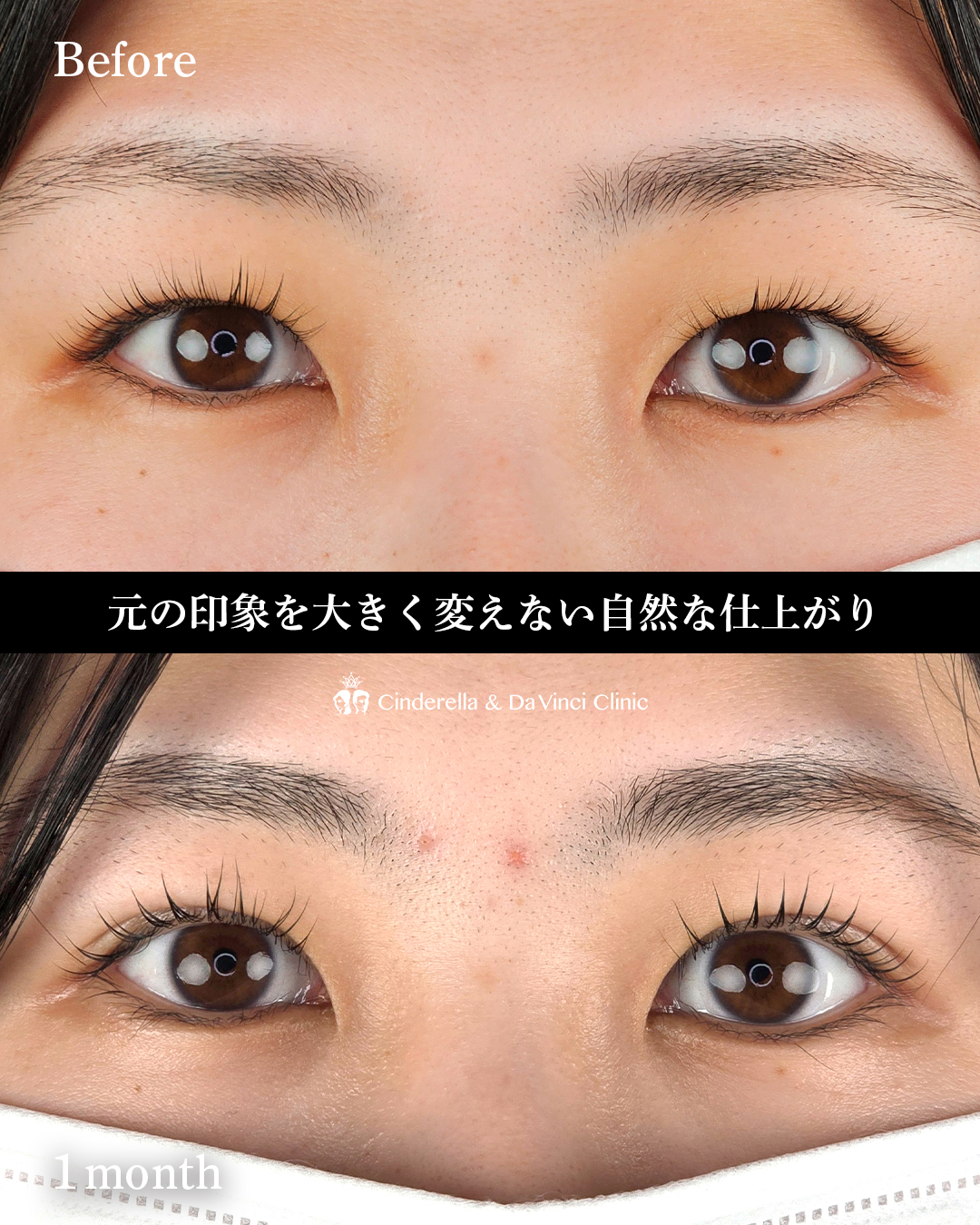 末広二重でもぱっちりの画像