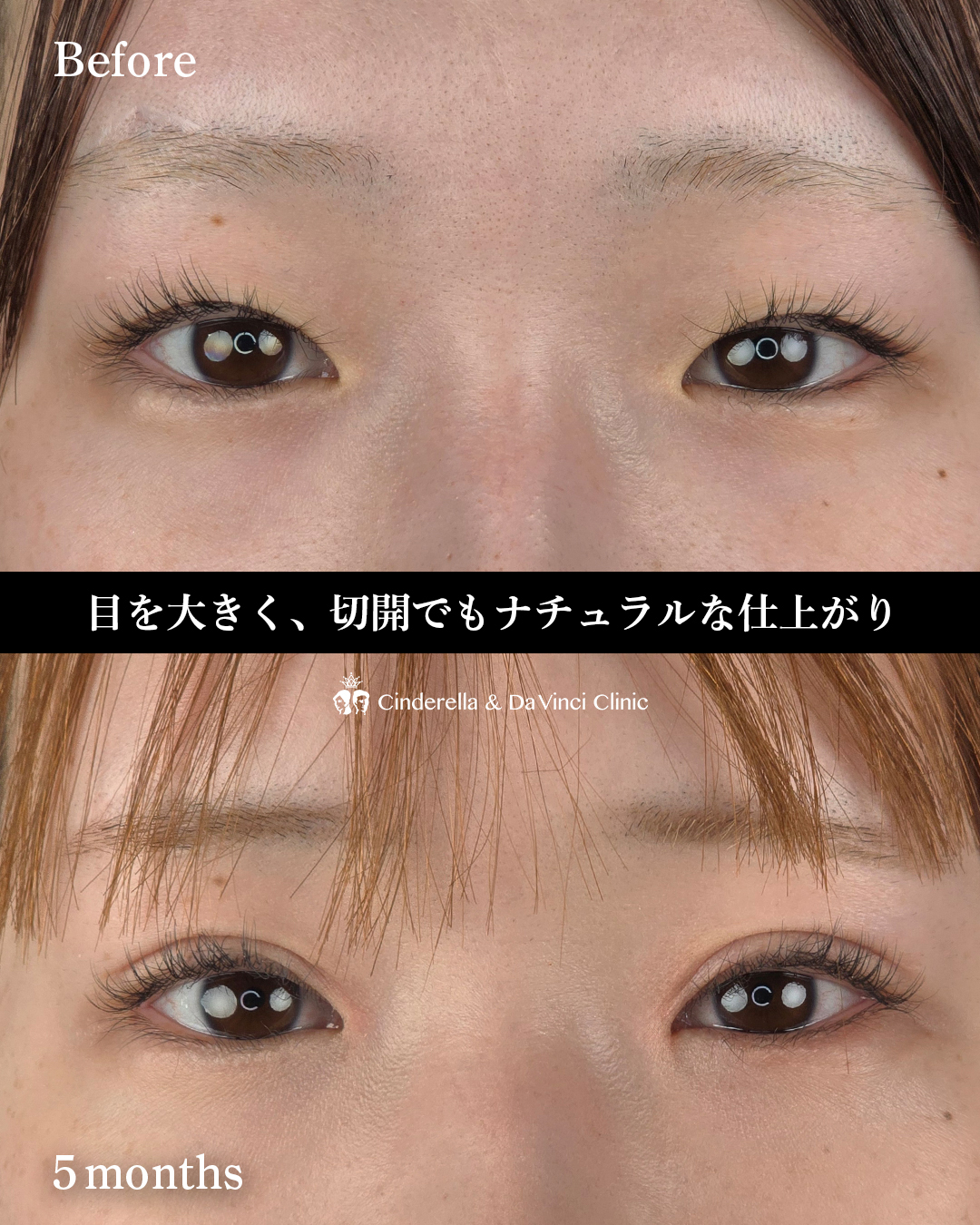 目を大きくするの画像