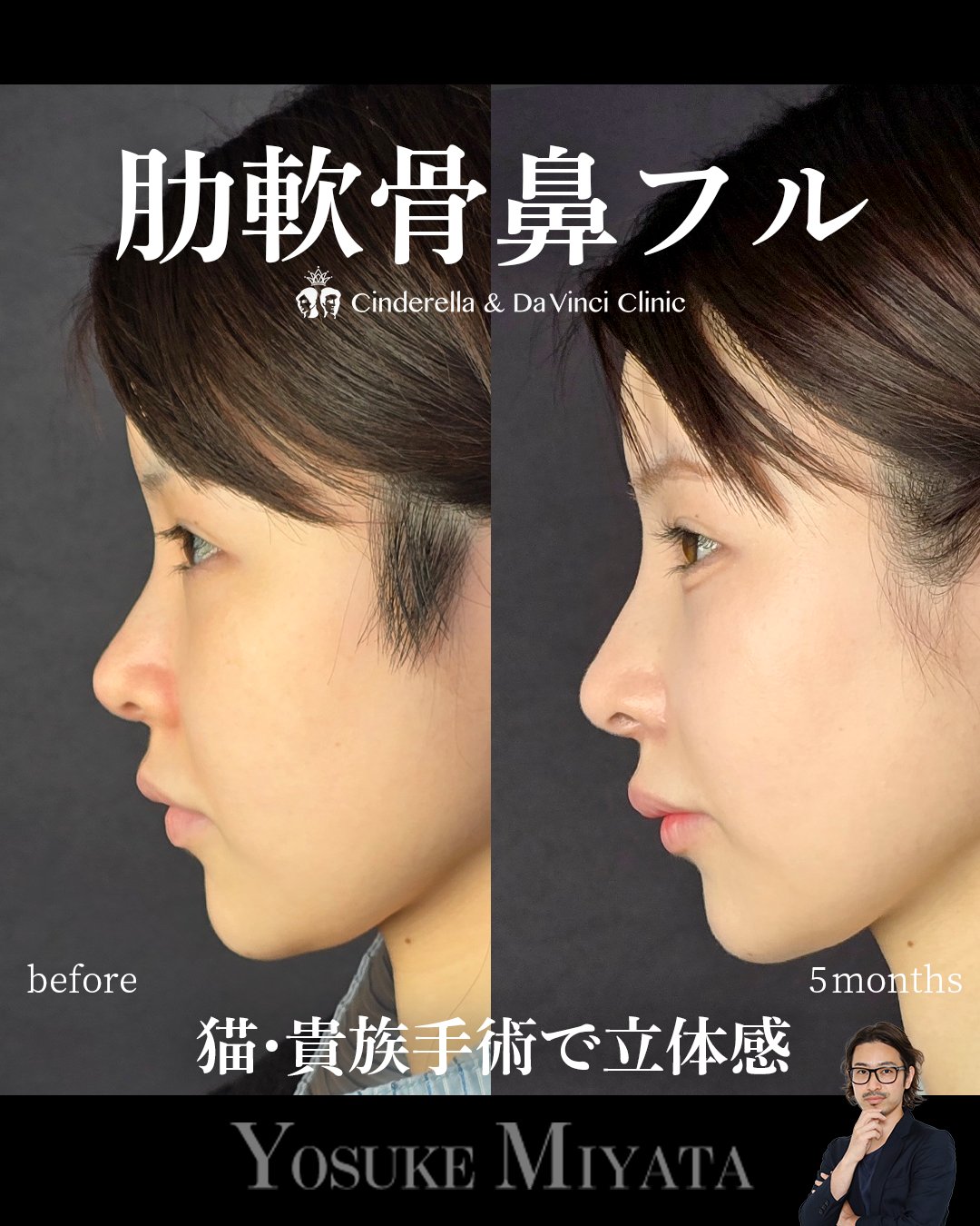 忘れ鼻をつくるの画像