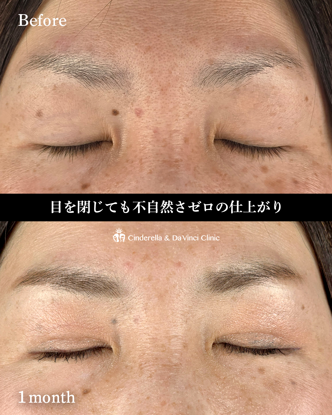 末広二重でもぱっちりの画像