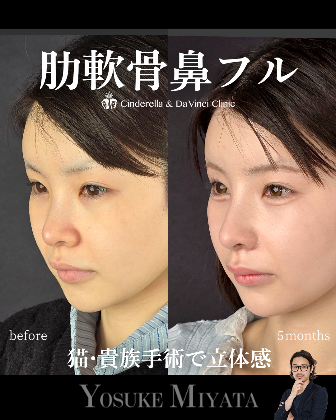忘れ鼻をつくるの画像