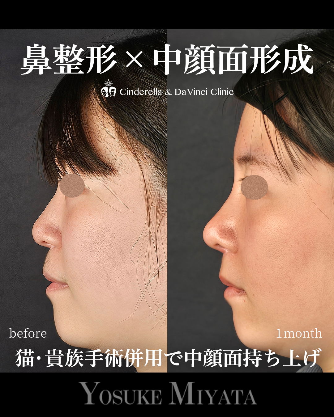 猫手術と貴族手術